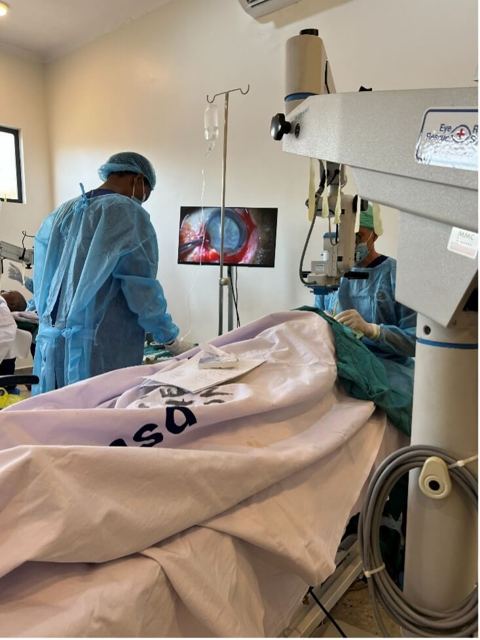Cataract surgery under the microscope with video on screen
